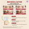 SEOUL 1988 Cream Retinal Liposome 1% + Fermented Rice  50ml